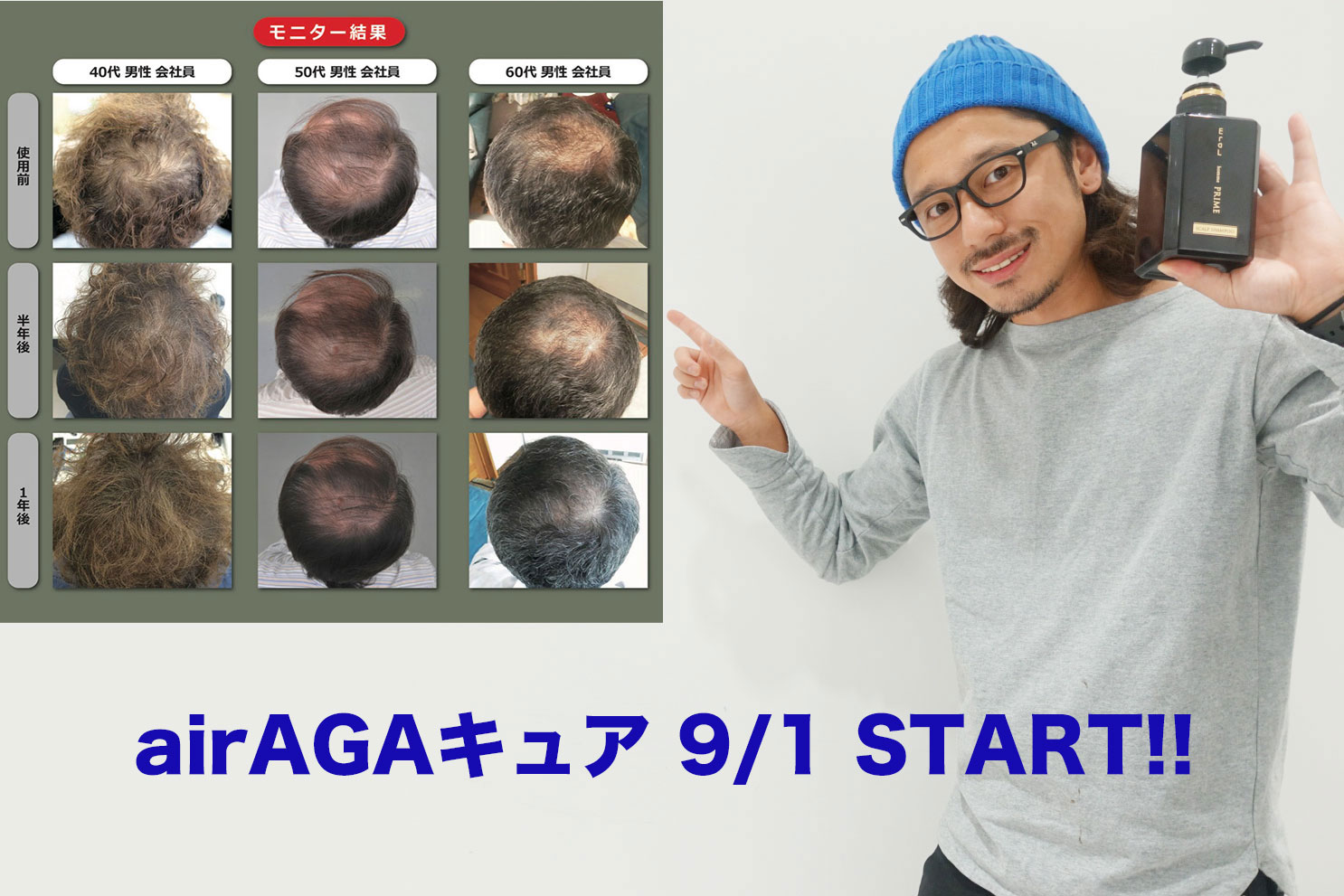 LOVEST銀座で、気軽にできる【AGAケア】はじめました！ | 薄毛・抜け毛予防・ボリュームアップに!![イーラルオムプライム]